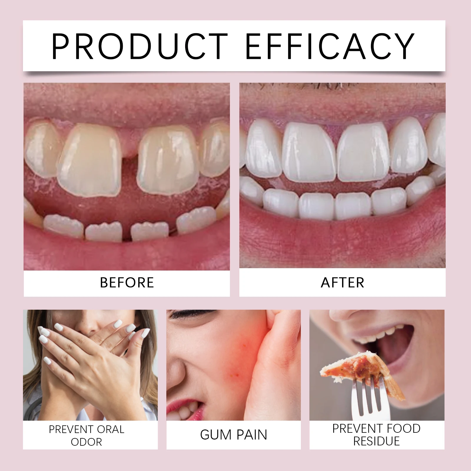 Denture Fixing Adhesive Cream Strong Complete Professional Dentures Glue Prevents Denture Loosening Care Fixed Adhesive 28g - Image 5