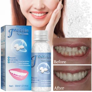 10/20/30ml Temporary Tooth Repair Beads Missing Broken Teeth Filling Material False Teeth Solid Glue Resin Denture Beauty Tools